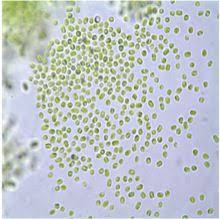 Attēlu rezultāti vaicājumam “Dermatocarpon luridum”