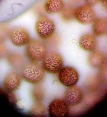 Attēlu rezultāti vaicājumam “Badhamia lilacina var. megaspora”