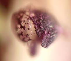 Attēlu rezultāti vaicājumam “Claustria didermoides stalked”