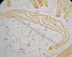 Attēlu rezultāti vaicājumam “Lasiosphaeria ovina spores”
