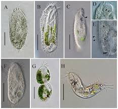 Attēlu rezultāti vaicājumam “Heterotrichia oerstedii (syn. Arcyria oerstedii) stalked”