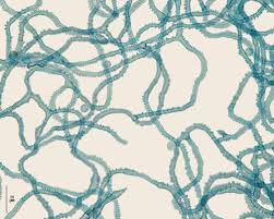 Attēlu rezultāti vaicājumam “Arcyria affinis spores”