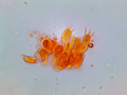 Attēlu rezultāti vaicājumam “Flaviporus citrinellus”