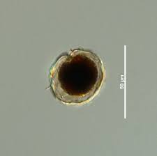 Attēlu rezultāti vaicājumam “Physarum alexandrowiczii sessile”