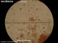 Attēlu rezultāti vaicājumam “Trichia crateriformis spores”