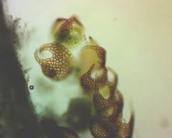 Attēlu rezultāti vaicājumam “Odontoschisma denudatum cells”