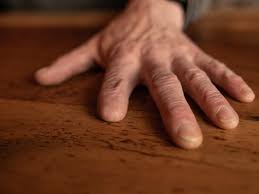 Znalezione obrazy dla zapytania palec