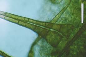 Attēlu rezultāti vaicājumam “Octospora splachnophila spores”