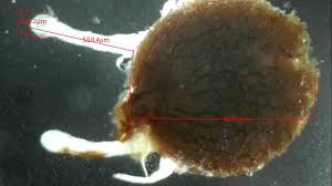 Attēlu rezultāti vaicājumam “Cribraria rubiginosa spores”