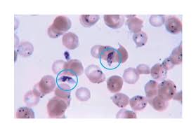 Attēlu rezultāti vaicājumam “Reticularia lobata plasmodium”