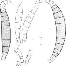 Image result for Hendersonia epidendri