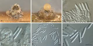 Attēlu rezultāti vaicājumam “Ombrophila violacea spores”