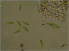 Attēlu rezultāti vaicājumam “Opegrapha atra”