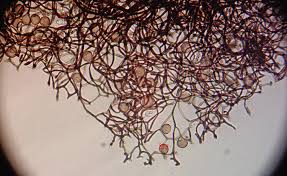 Attēlu rezultāti vaicājumam “Comatricha alta spores”