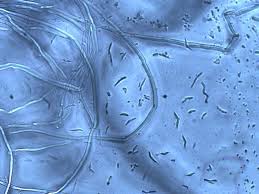 Attēlu rezultāti vaicājumam “Eocronartium muscicola”