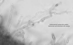 Attēlu rezultāti vaicājumam “Radulomyces confluens”