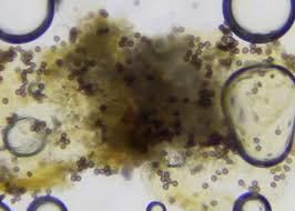 Attēlu rezultāti vaicājumam “Didymium xanthopus”