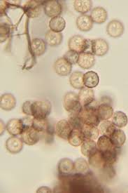 Attēlu rezultāti vaicājumam “Stemonitis foliicola spores”