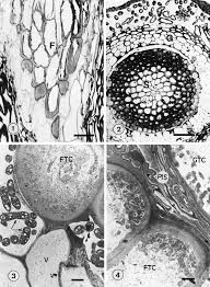 Attēlu rezultāti vaicājumam “Acaulon muticum sporophyte”
