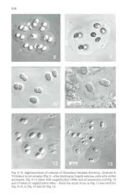 Attēlu rezultāti vaicājumam “Gloeocapsa rupestris”