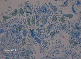 Attēlu rezultāti vaicājumam “Microcalicium disseminatum”