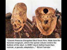 Image result for elongated skulls