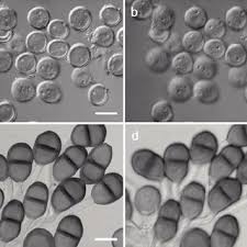 Attēlu rezultāti vaicājumam “Coleosporium sp.”