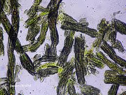 Attēlu rezultāti vaicājumam “Cystocoleus ebeneus”