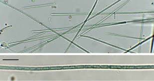 Attēlu rezultāti vaicājumam “Chaetophora pisiformis”