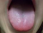 I include more <b>tongue</b> pictures