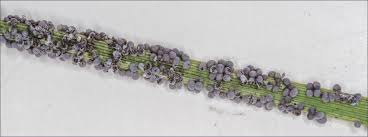 Attēlu rezultāti vaicājumam “Physarum alexandrowiczii sessile”