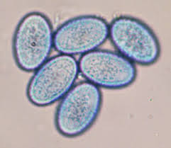 Attēlu rezultāti vaicājumam “Scutellinia scutellata”