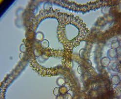 Attēlu rezultāti vaicājumam “Arcyria incarnata spores”