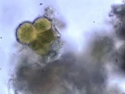 Attēlu rezultāti vaicājumam “Pleurococcus vulgaris”