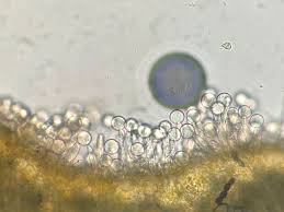 Attēlu rezultāti vaicājumam “Cribraria costata spores”