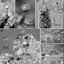 Attēlu rezultāti vaicājumam “Physarum bryocorticola spores”