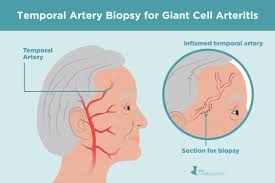 Image result for GCA