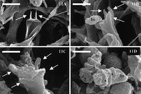 Attēlu rezultāti vaicājumam “Exobasidium splendidum”