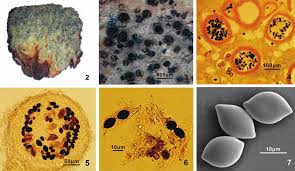 Attēlu rezultāti vaicājumam “Melanospora lagenaria”