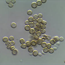 Attēlu rezultāti vaicājumam “Chaenotheca trichialis”