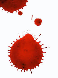 Image result for Gambro BCT Trima