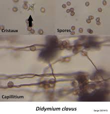 Attēlu rezultāti vaicājumam “Didymium clavus spores”