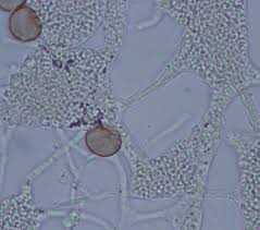 Attēlu rezultāti vaicājumam “Craterium aureum spores”