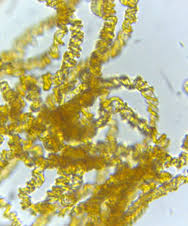 Attēlu rezultāti vaicājumam “Physarum bitectum sessile”