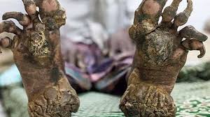 Image result for Lewandowsky-Lutz