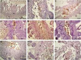Attēlu rezultāti vaicājumam “Pterostichus oblongopunctatus”