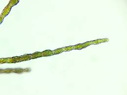 Attēlu rezultāti vaicājumam “Cystocoleus ebeneus”