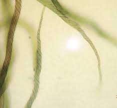 Attēlu rezultāti vaicājumam “Hemitrichia decipiens young”