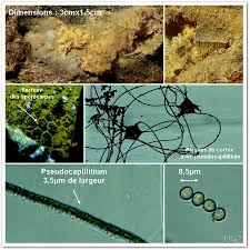 Attēlu rezultāti vaicājumam “Dictydiaethalium plumbeum spores”