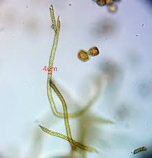 Attēlu rezultāti vaicājumam “Trichia longipalpis sessile”